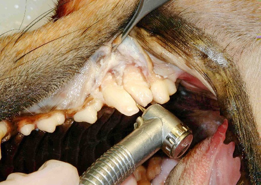 Surgical extraction